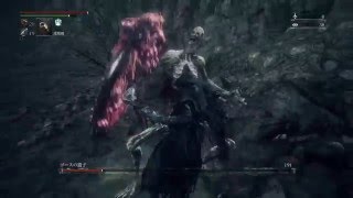 Bloodborne® ブラッドボーン 「ゴースの遺子」 第一形態が長引いたパターン(敗北) (DLC)