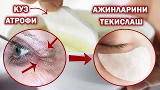 Anti-aging Removal of under-eye wrinkles and bags under the eyes in a day