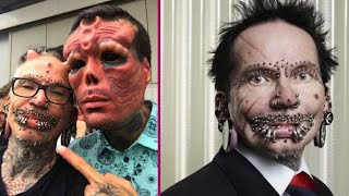 Rolf Buchholz - Meet The Man With A World Record For Most Body Modifications