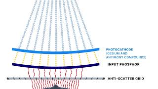 What is an image intensifier, and why is it important?: Fluoroscopy systems and components