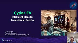 Intelligent Maps for Endovascular Surgery