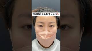 20代女性、何の目整形をしたでしょう⁉️