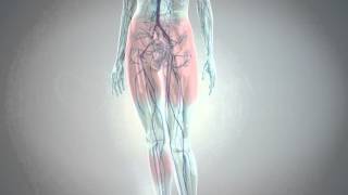 Treatment of Varicose Veins, Spider Veins & Pelvic Congestion Syndrome