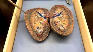 Urinary system: Part 3 - Kidney dissection