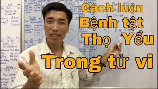 Cách luận giải lá số tử vi - tuổi thọ - bệnh tật - cung tật trên lá số tử vi