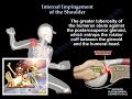 Internal Impingement  of the shoulder- Everything You Need To Know - Dr. Nabil Ebraheim