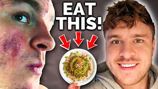 Foods That Clear Acne (Acne Friendly Recipe | SALSA BOWL)