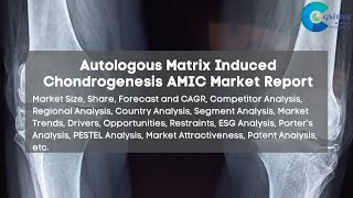 Autologous Matrix Induced Chondrogenesis AMIC Market Report