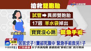 奇蹟!雙胞胎一寶胎死腹中 緊急手術順利產子│中視新聞 20211208