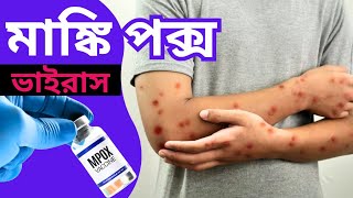 এমপক্স কী? | এটা কীভাবে ছড়ায়? | এ রোগের লক্ষণগুলো কী? | MPOX VIRUS