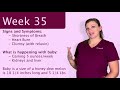 dr. mandi s 35th week of pregnancy