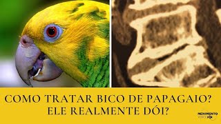 Bico de Papagaio ou Osteófito é grave?| É possível melhorar a dor mesmo com vários deles?