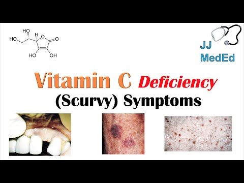 Scurvy: Symptoms, Causes And Treatment Of This Disease - Psychology - 2024