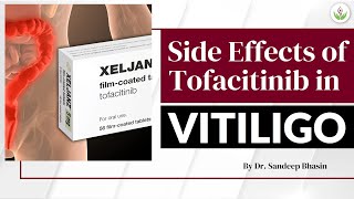 Potential Side Effects of Tofacitinib In Vitiligo - Dr. Sandeep Bhasin | Care Well Medical Centre