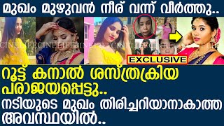 മുഖം മുഴുവന്‍ നീര് വന്ന് വീര്‍ത്തു.. നടിയുടെ മുഖം തിരിച്ചറിയാനാകാത്ത അവസ്ഥയില്‍..! l actress swathi