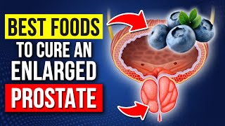 These Are The BEST and WORST Foods For Enlarged Prostate