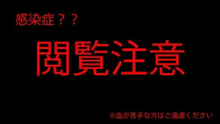 【閲覧注意】メンバーがいきなり吐血しました。