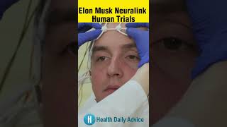 Elon Musk's Neuralink Brain Chips Approved for Human Trials