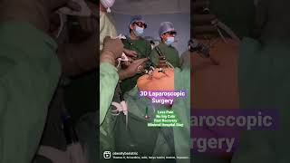 3D Laparoscopic Surgery in India I Operation Theater Kaise hota hai ?