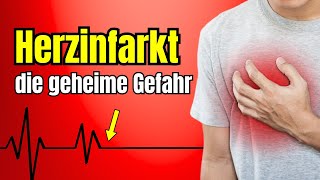 Herzinfarkt: Was wirklich hinter den Zahlen steckt!