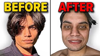 10 Bad Habits That Make You Ugly (Science Based)