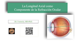 La Longitud Axial del Ojo Humano como Componente de la Refracción Ocular.