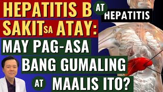 Hepatitis B at Sakit sa Atay: May Pag-asa bang Gumaling at Maalis Ito? - By Doc Willie Ong