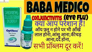 Optibex Tear best eye drop/Uses/Dosage/effect/आखों का लाल होना/सुजन/दर्द/जलन से छुटकारा/baba medico.