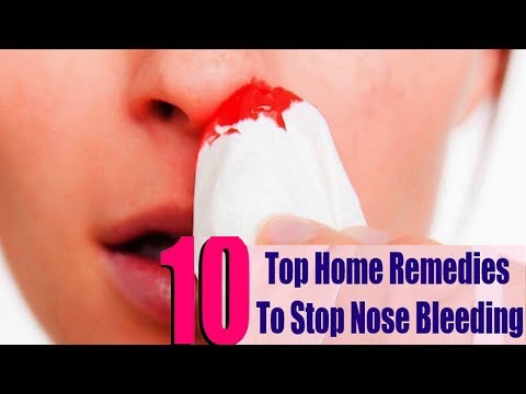 Nosebleed - How to Stop a Nosebleed Fast | 5 Ayurvedic Home Remedies + Prevention | Nosebleed - How to Stop a Nosebleed Fast | 5 Ayurvedic Home Remedies + Prevention |