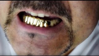 Fitting Bottom Teeth Grillz