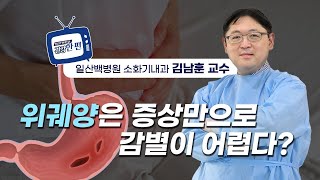 [일산백병원TV] 위궤양은 증상만으로 감별이 어렵다?