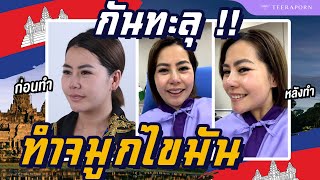 เสริมจมูกไขมันหลังทำทันที From Cambodia