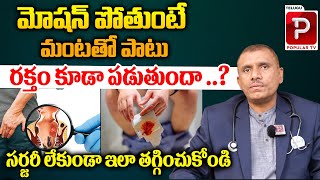 How To Cure Piles Fissure Explained Dr Ramana Raju | Medi 9 Hospitals | Telugu Popular TV