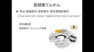 #8-1(ILAE2017対応)：代表的なてんかん発作のみかた
