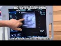 ಆನೆಕಾಲು ರೋಗ @adhventhahospital_bengaluru drbhaskarmv viralvideo elephantiasis