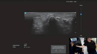 Live Demo: Ultrasound Evaluation of the Elbow