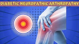 Things You Should Know about Neuropathic Arthropathy