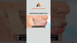 Protrusion Correction | Answer Plastic Surgery #shorts #protrusioncorrection