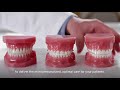 announcing 3m clarity aligners video