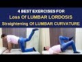Lumbar lordosis, Lumbar spine curvature, Loss of Lumbar Lordosis Exercises, Flat Back Exercises