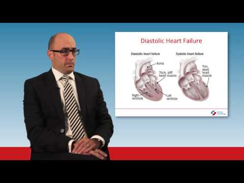 Diastolic Heart Failure diagnoisis and treatment Diastolic Heart Failure diagnoisis and treatment
