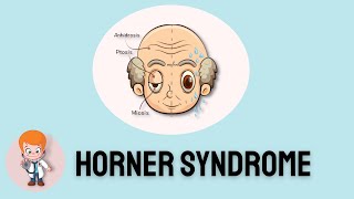 Horner Syndrome: Signs and symptoms and insights