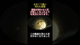 好きな人だけ見て👀#earwax #ear #気持ちいい #耳垢 #耳かき動画 #耳かき #スッキリ