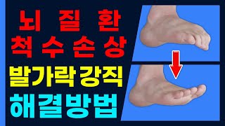 뇌경색 뇌출혈 모든뇌질환 척수손상 발가락 강직 해결 재활운동방법Stroke spinal cord injury toe rigidity solution