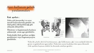 Çocuk ve adolesanlarda  over- use sendromları