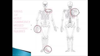 COMMONLY MISSED INJURIES IN CASE OF POLYYTRAUMA PATIENTS