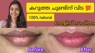 കരിക്കട്ട ചുണ്ടും ചുമക്കാൻ ഒരു ദിവസം മതി💯live result 😳@ima_makeovers #lipcare #lippigmentation