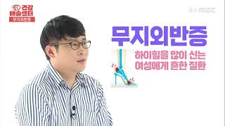 제 2의 심장인 발! 여성에게 흔한 질환인 무지외반증이 사실은 남녀 상관없이 모두에게 흔하다?