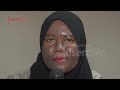 cerita nur tya muka gosong akibat skincare berbahan merkuri