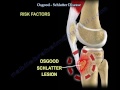 Osgood Schlatter Disease - Everything You Need To Know - Dr. Nabil Ebraheim